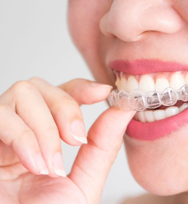A smiling woman holding invisalign or invisible braces, orthodontic equipment